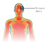 TTP Temporal Artery Location